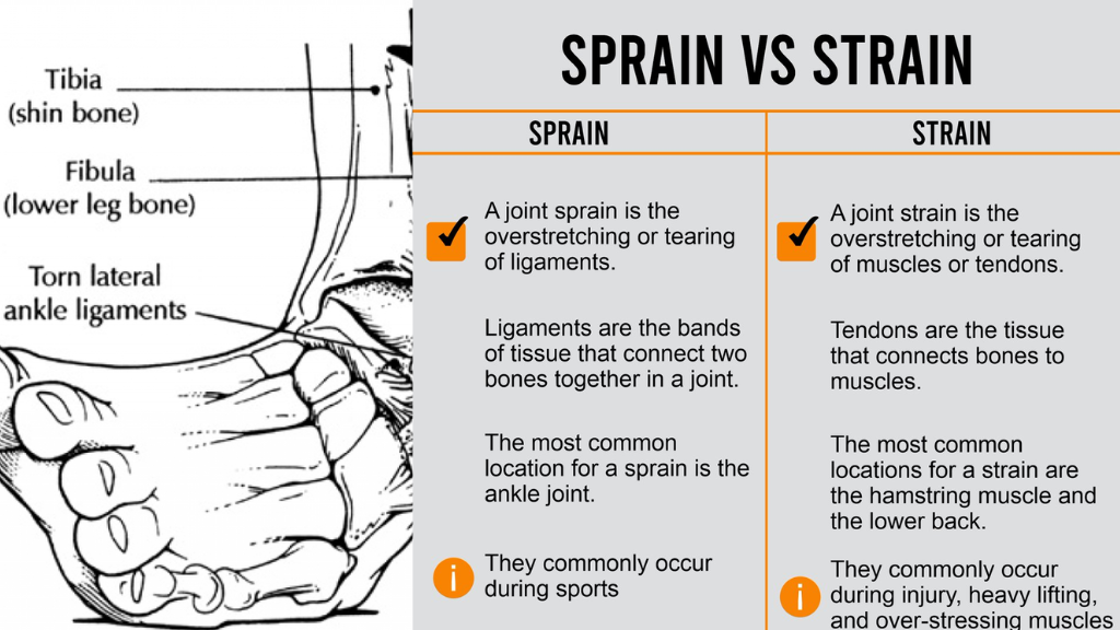Strain & Sprain