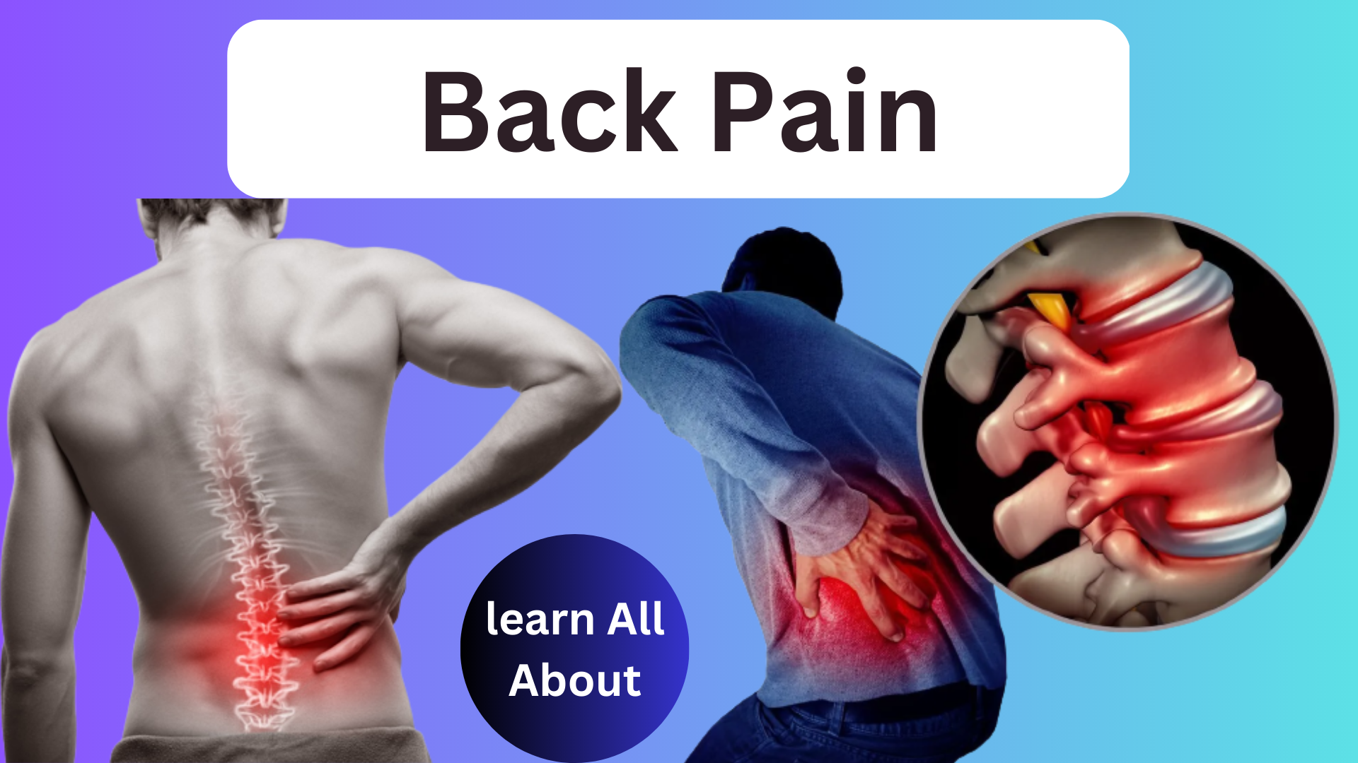 Back Pain Causes Types Diagnosis Best Treatment Options