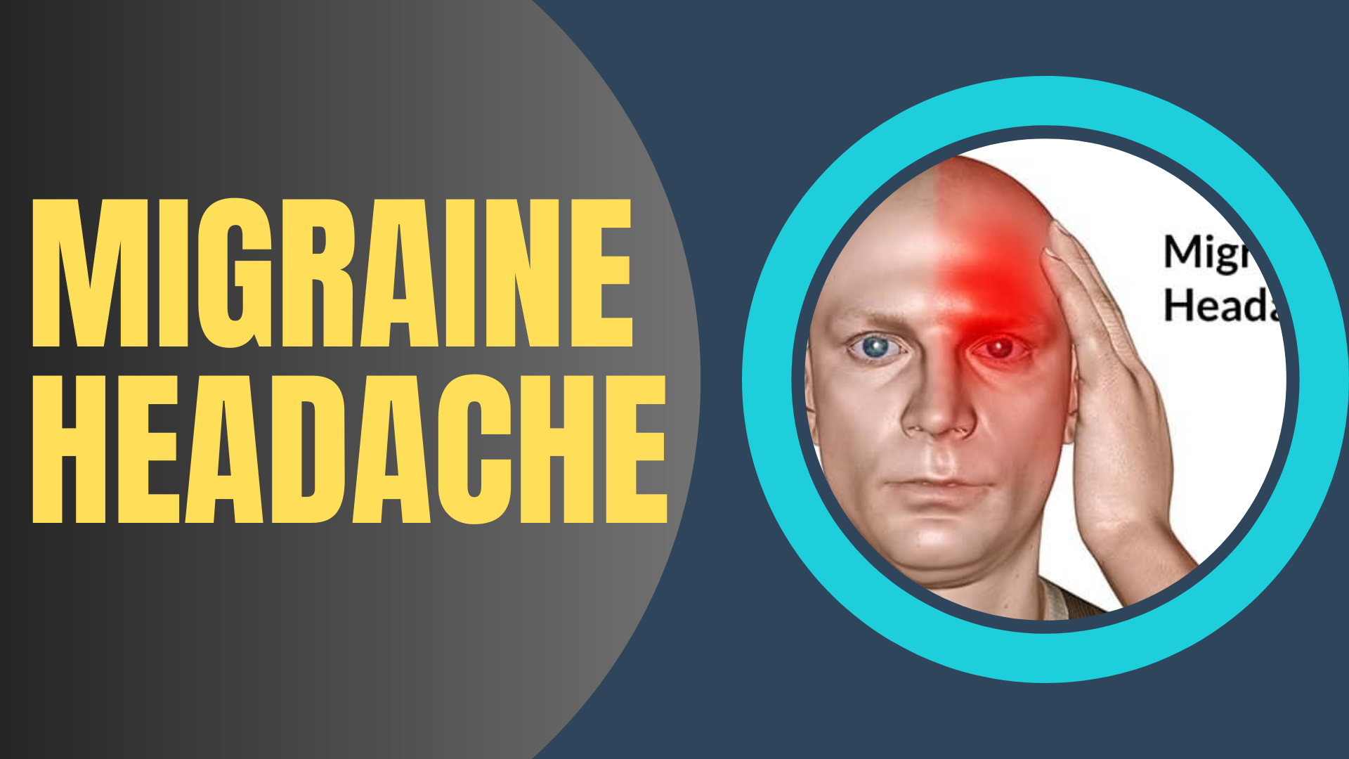migraine-headache