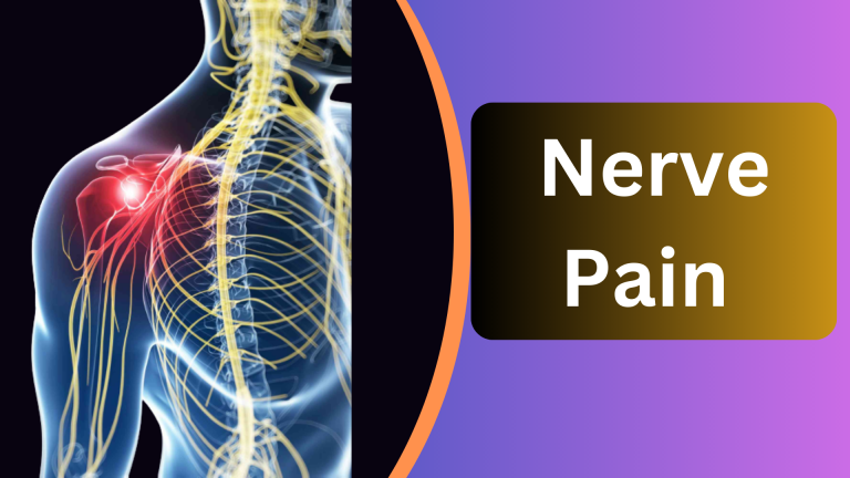 nerve-pain