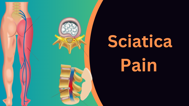 sciatica-pain