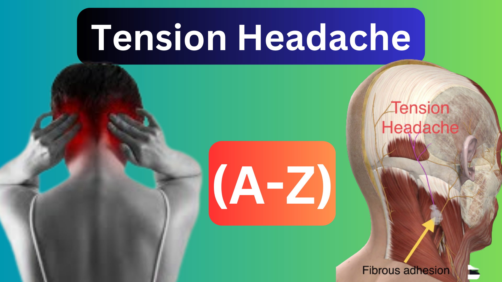 tension-headaches